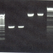 Ergenisse der PCR